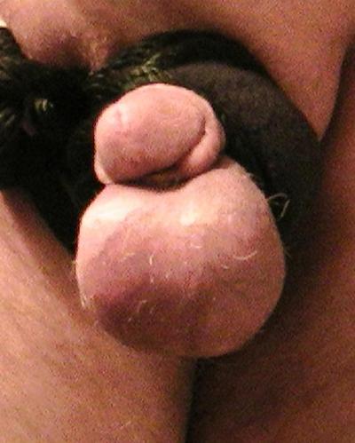 9P CBT
