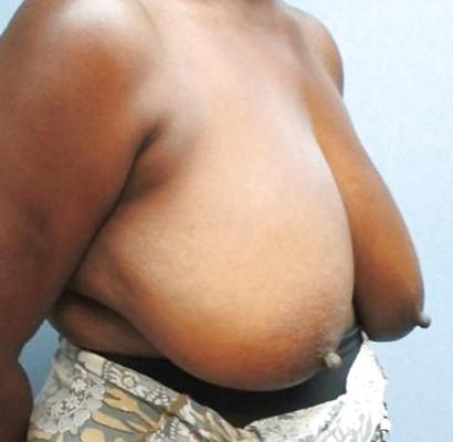25P Big black areolas part 32