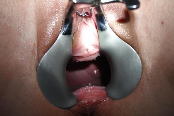 8P Speculum