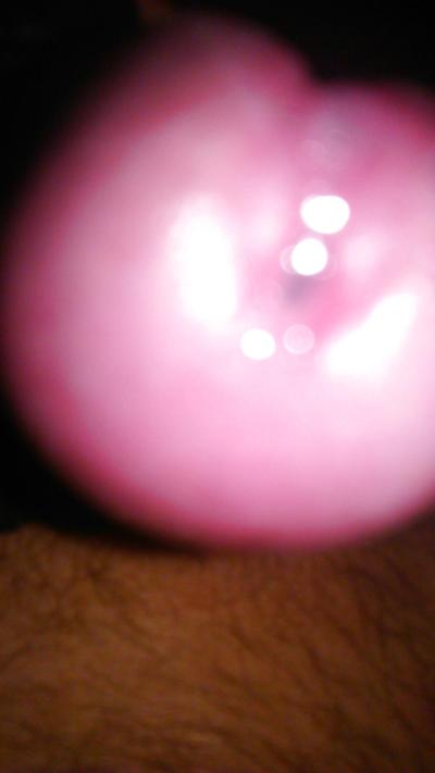 5P Pre cum