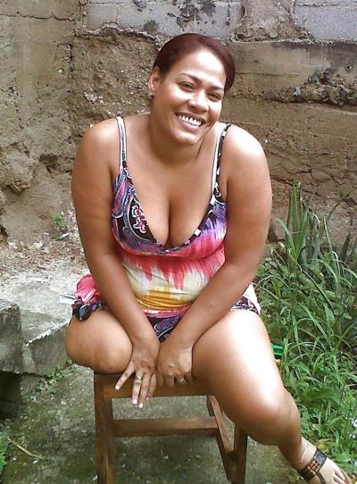 22P Amputee girls are so sexy