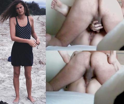 20P Before-after compilation