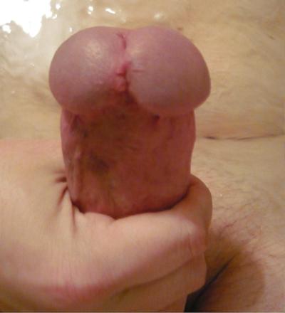 4P Me fat mushroom dick