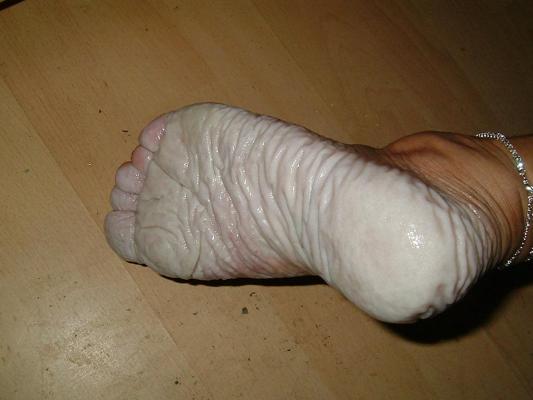 13P Bianca's 24 to 80 hours wet feet