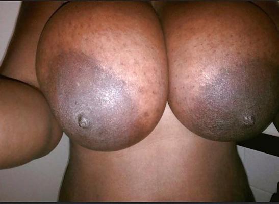 5P Big dark areolas boobs