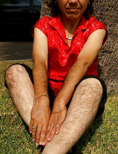 9P Women hairy legs