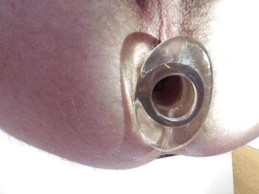 10P Tunnel Butt Plug