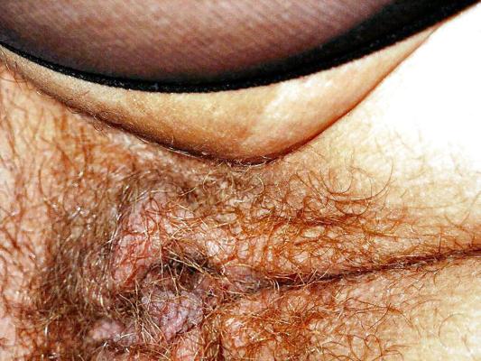 12P Hairy Urwaldmoesen 
