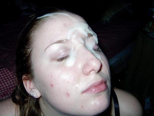 11P Acne Girls Need Cum on Their face 