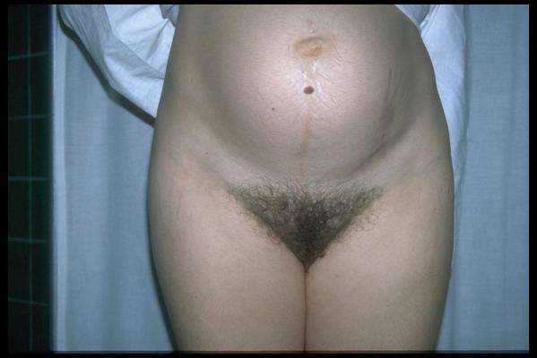 6P Hairy pregnant women 4