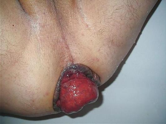 6P Prolapse male cunt