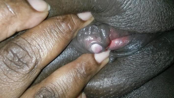 11P Clit & Pussy