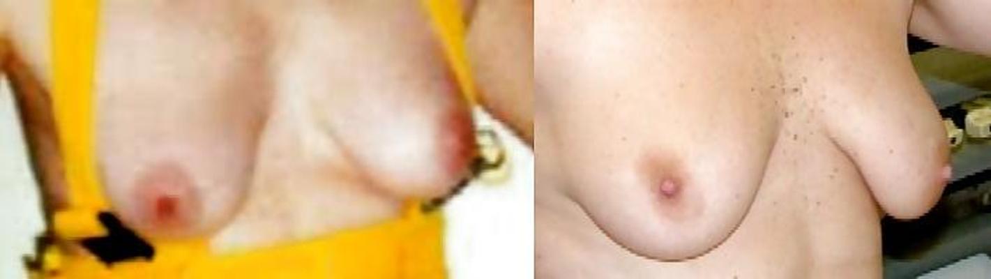 9P Wife & Stepdaughter - topless & Dressed 