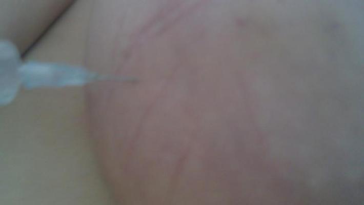 6P Scottish slut self harm