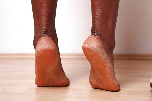 24P Amateur Feet 3