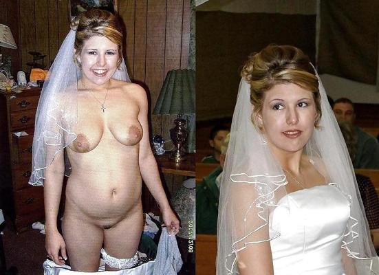 18P Before after 334. (Brides special)