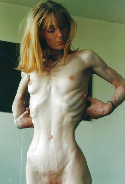 12P Skinny, Haut und Knochen ! Ist das noch sexy?