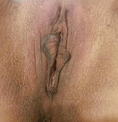 5P After wax