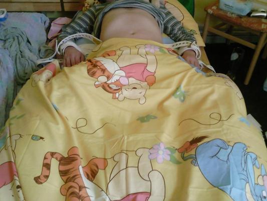 25P Fixed on Bed in Diaper 