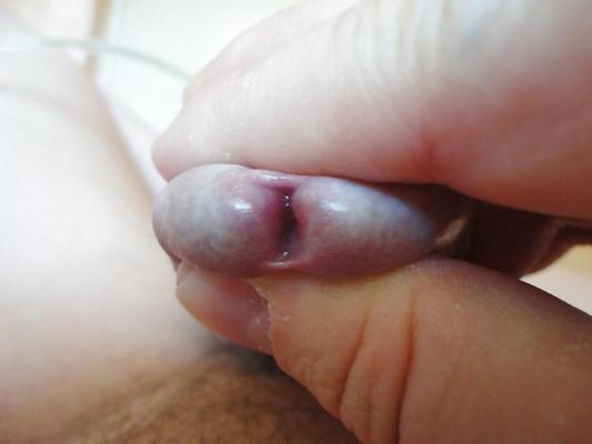 7P CLOSE UP  PEEHOLE  my mein Nille Glied Eichel