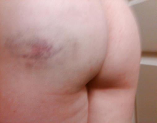 4P My ass after my birthday spanking