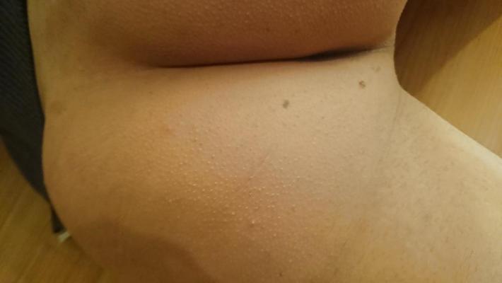 20P Twink ass