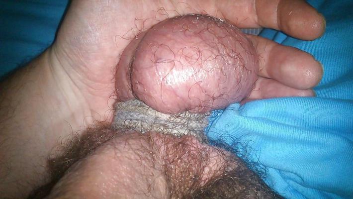 6P CBT extremo