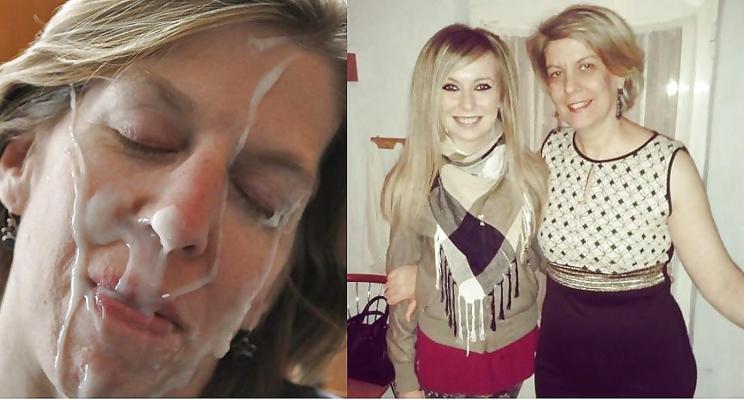 6P Before and After Facials