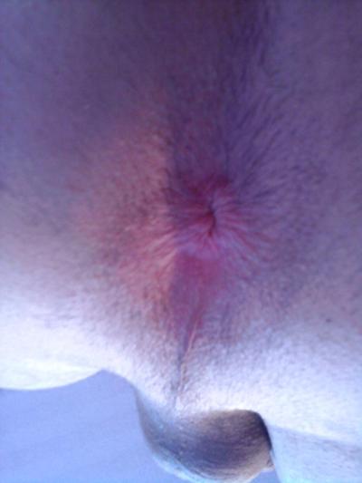 7P Cuzinho de menino amador adolescente