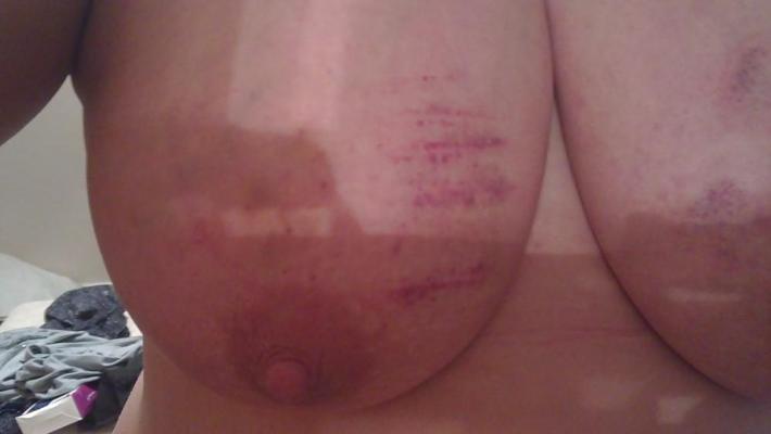 6P Scottish slut tit torture