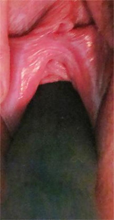 25P Pussy Close-Ups