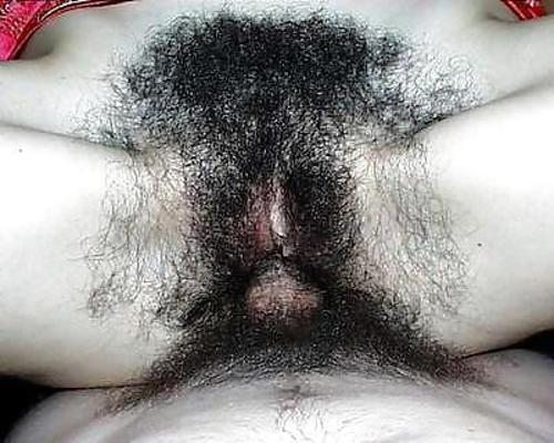 25P Hairy Cunts 3
