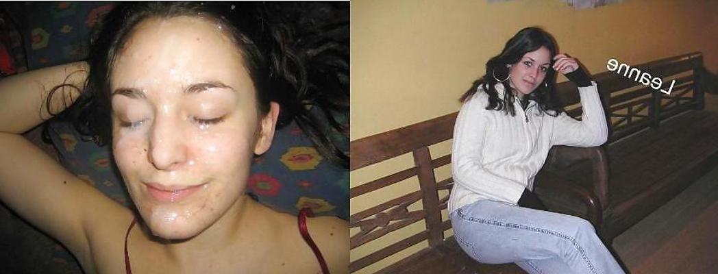 25P Before and After 4