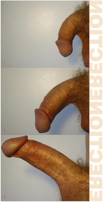 11P FRANK'S HUGE COCK: The Collection