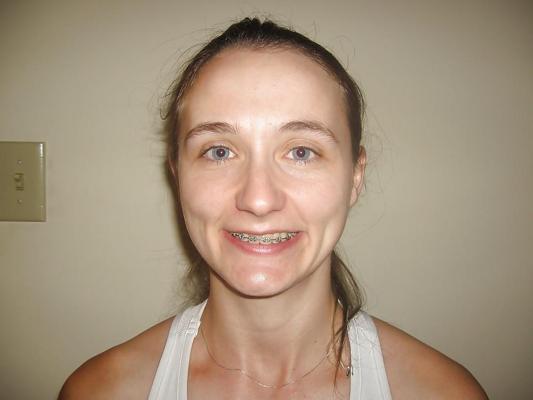 4P 38 yr old mom lisa fotheringham (ugly)