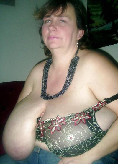 25P Big huge melons
