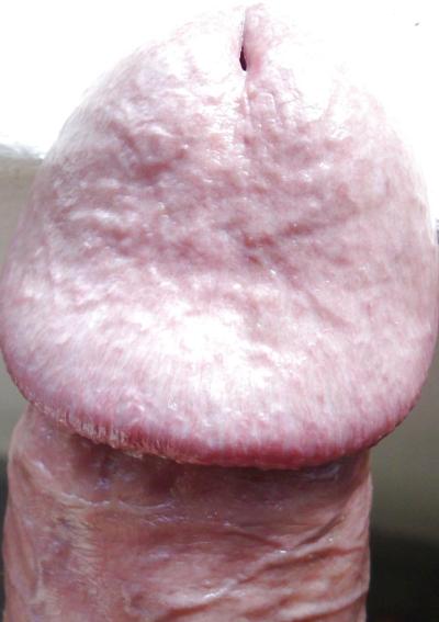 11P FRANK'S HUGE COCK: Detail of Head