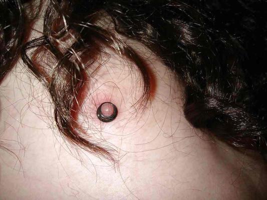 5P Nipples