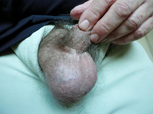 5P Horny balls