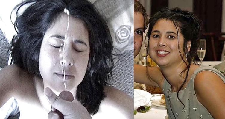 10P Before After Special Facial - F94