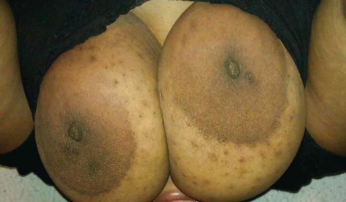 25P HUGE TITS