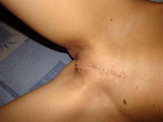 15P Tiny teen slut showing her sweet panties