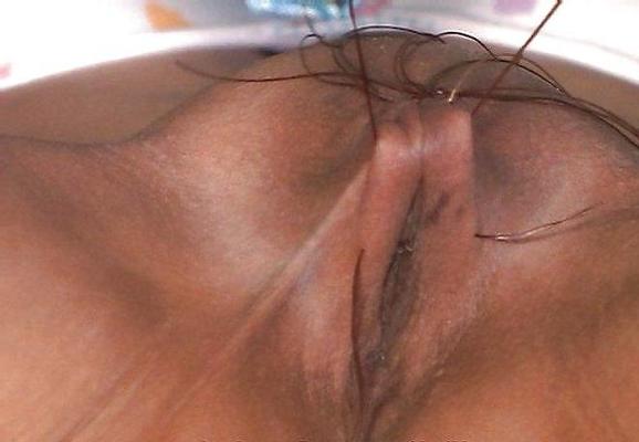 11P Sewn up pussy