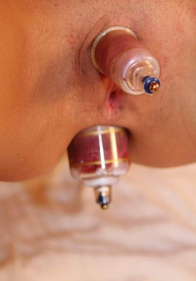 18P extremely gaping ass and pussy holes