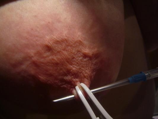 12P Urethral Play