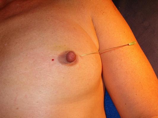 16P Extreme needle bdsm and mature german slavery pain