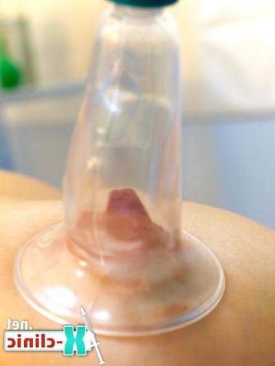 14P Babe getting medical control