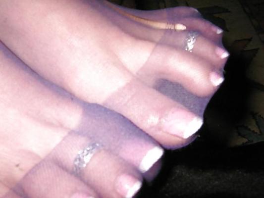 17P Nylon feet