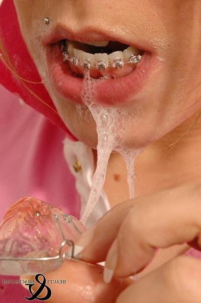 16P Babe in shiny wet metal mouth braces sloppily brushing her teeth