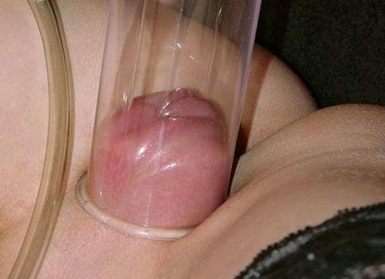 12P extreme pumped and swollen female private parts